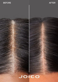 Scalp Vitality Exfoliating Foaming Scrub