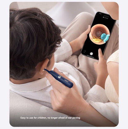 Smart Visual Ear Cleaner – HD Camera Ear Wax Removal Tool with WiFi.